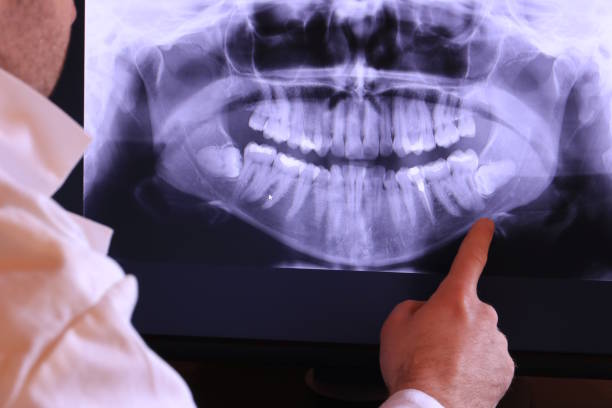 Best Weekend Emergency Dentist in Dorr, MI