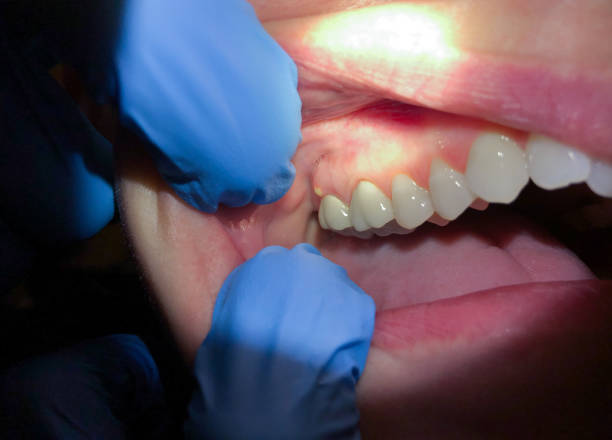 Best Emergency Dental Extractions in Dorr, MI