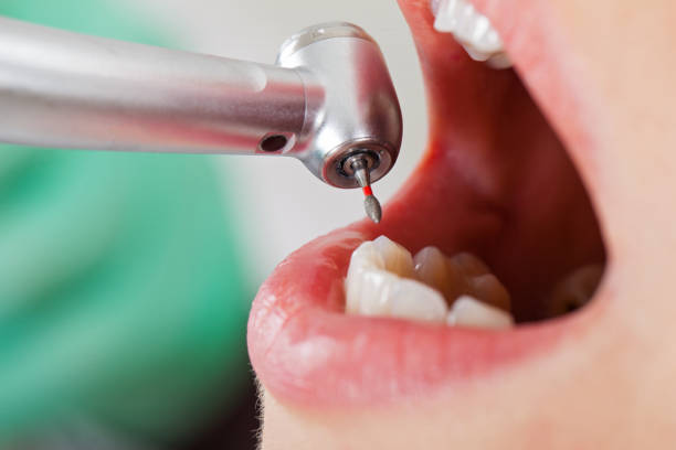 Best Emergency Dental Extractions in Dorr, MI